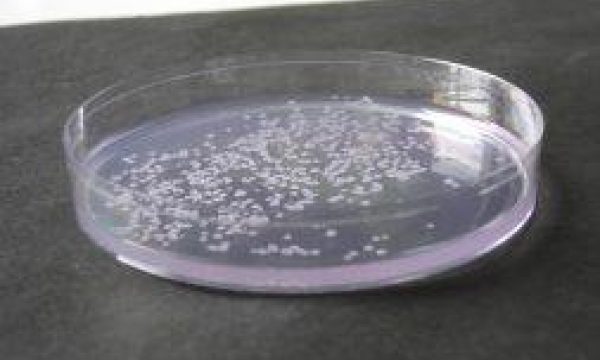 Bacterial growth on medium in petri dish