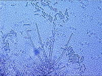 spores Thielaviopsis basicola