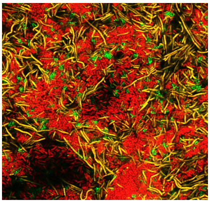 Confocal laser electron microscopy images of multispecies biofilms