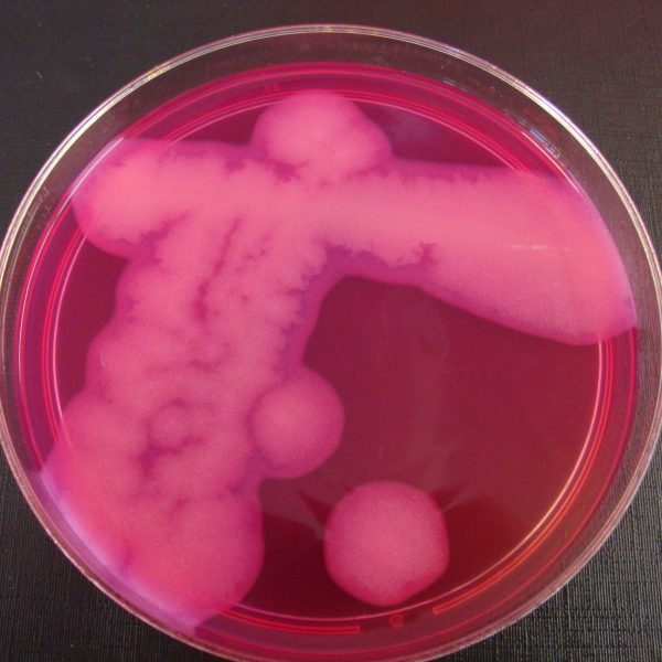red agar plate with pink B cereus growing on it