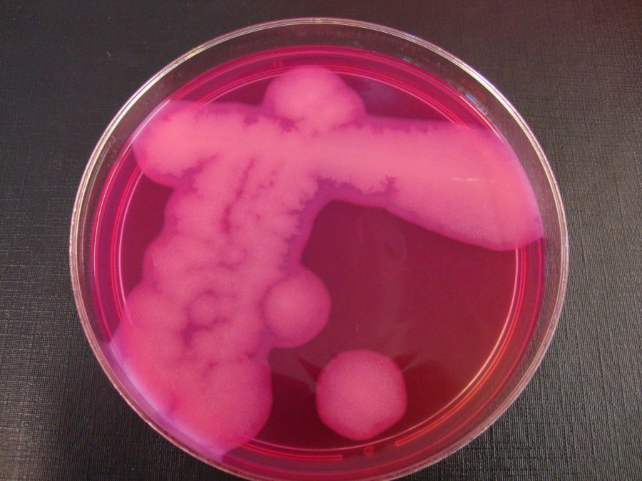 Petriplaat met cultuur van de bacterie cereus op een roze medium
