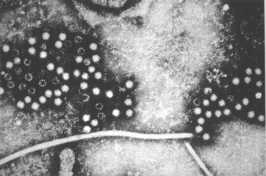 Zwartwit microscopische foto van Hepatitis E virus
